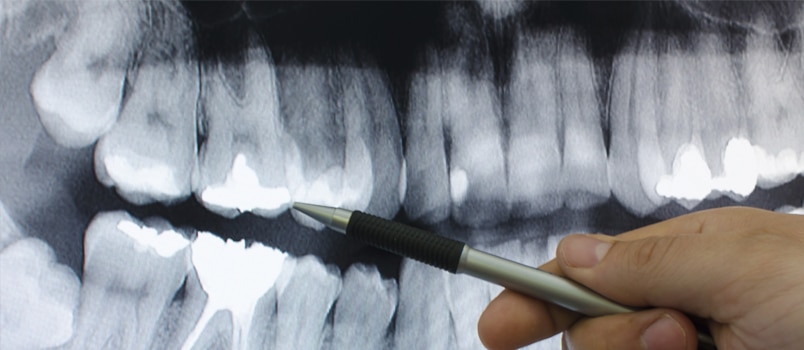 effective-radiographic-interpretation