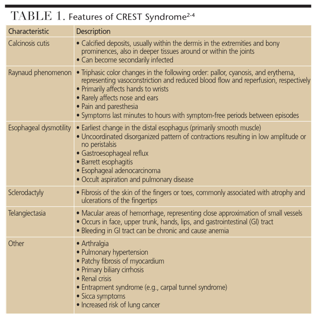 Managing Patients With CREST Syndrome - Decisions in Dentistry