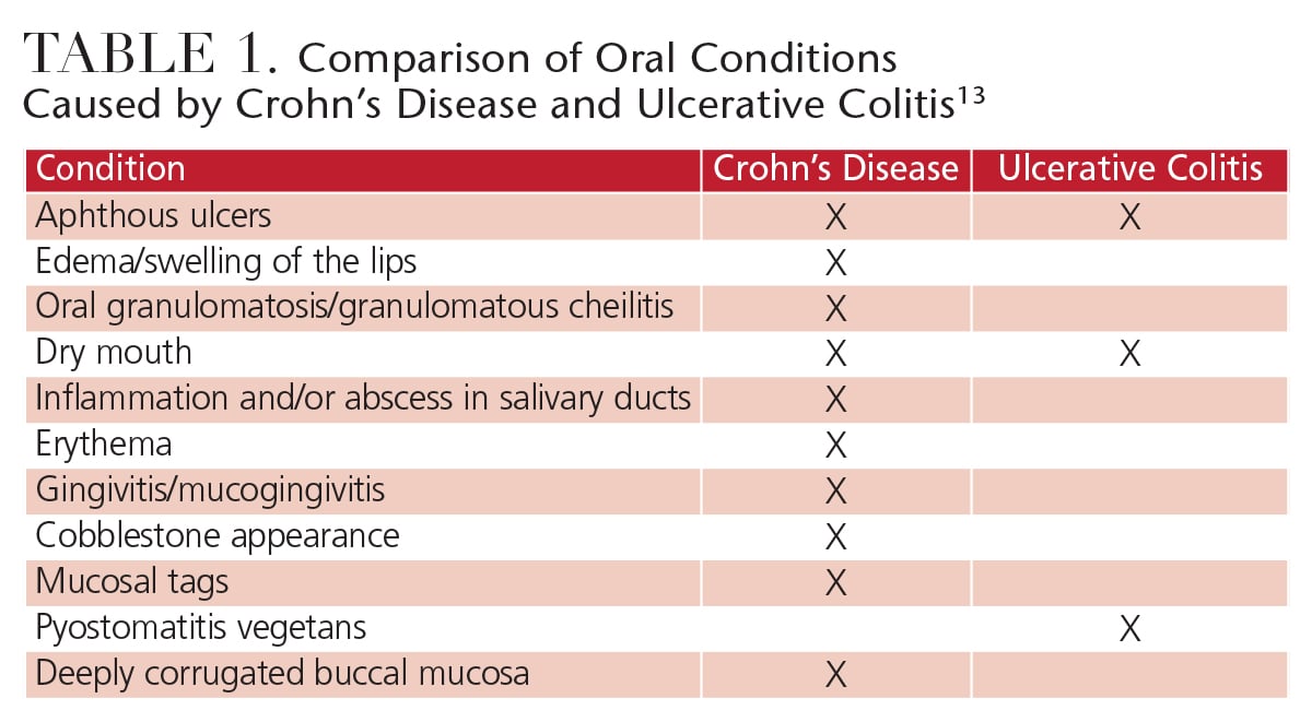 Cureus, Facial Presentation of Crohn's Disease: Report of a Case