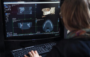 FIGURE 1. Digital imaging and special software allow three-dimensional (3D) visualizations. Clinicians can use these technologies in treatment planning, and also to develop aids — such as interocclusal wafers and implant surgical templates — that can be fabricated using 3D printers.