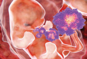 FIGURE 2. This illustration shows particles of the Zika virus (purple) and a fetus. In 2015, a previously unknown connection between Zika infection in pregnant women and microcephaly in newborns was reported. This can cause miscarriage or death soon after birth, or lead to developmental delays and disorders.