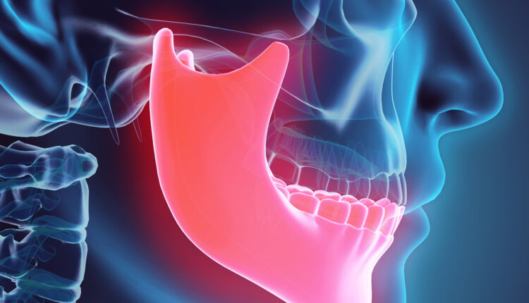 university-of-washington-surgeons-rebuild-patients-jaw-and-hard-palate