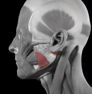 FIGURE 1. The masseter muscles are highlighted In this conceptual image of the facial muscles.