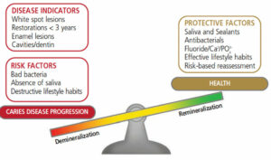 FIGURE 1.The Caries Imbalance.