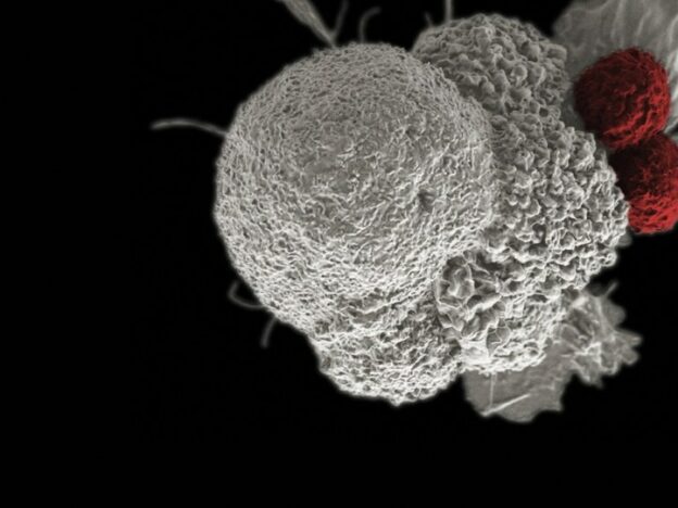 Oral Implications of Immunotherapy course image
