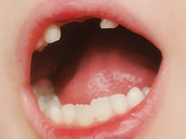 Interprofessional Management of Hypophosphatasia course image