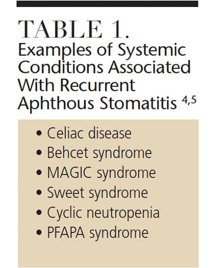 aphthous stomatitis treatment