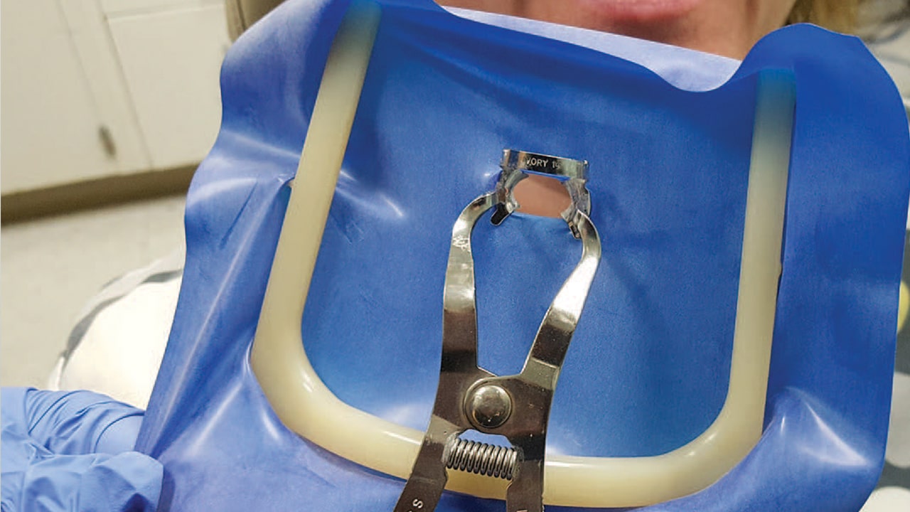 A simple guide to using dental dam