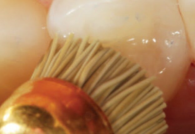Clinical Update on Composite Restoratives course image