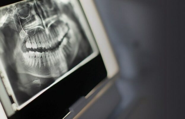 Identifying Carotid Artery Atheromas on Pantomographs course image