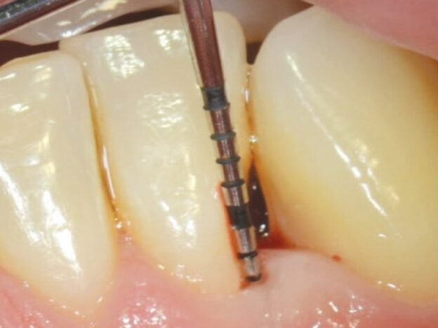 Strategies for Periodontal Risk Assessment and Prognosis course image