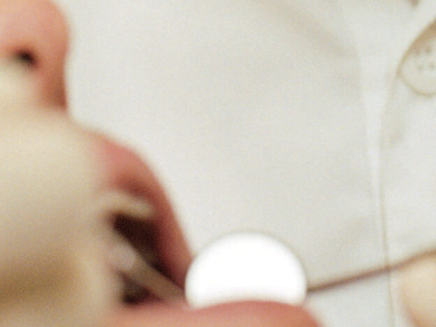 Conservative Caries Treatment course image