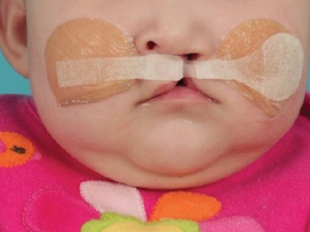 Dentists’ Evolving Role in Treating Cleft Lip and Palate course image