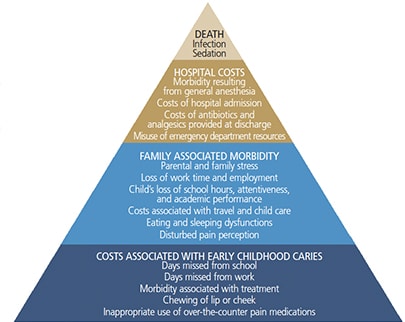 Smokeless Tobacco & Your Oral Health - Pyramid Family Dental