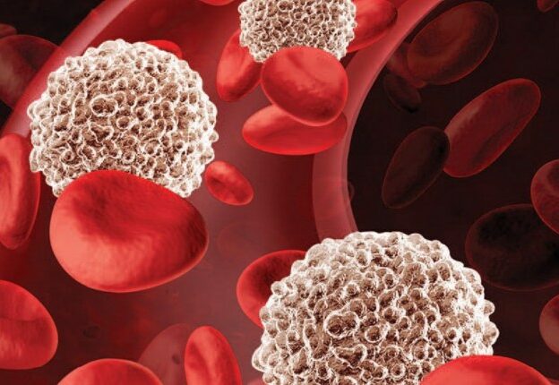 Enhance Healing Using Leukocyte Platelet Rich Fibrin course image