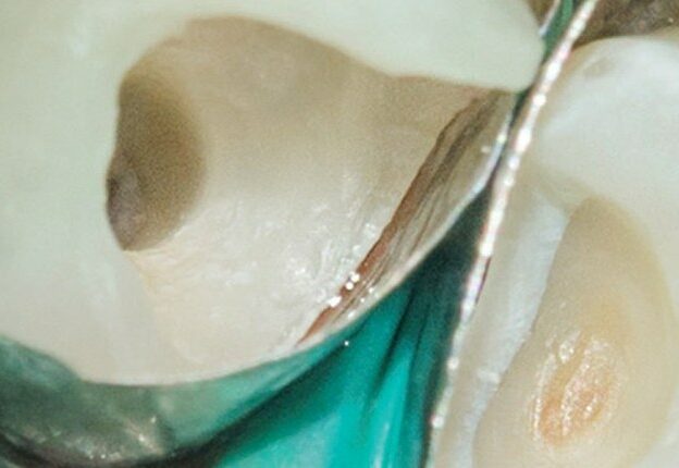 Innovations in Endodontic Cleaning and Disinfection course image