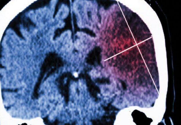 Treating Patients With Cardiovascular Disease and Stroke course image