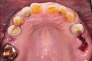 Maxillary Arch Esthetics