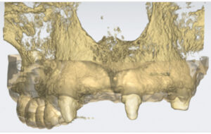 Digital Dentistry Technology