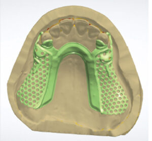 Digital Dentistry Digital Design