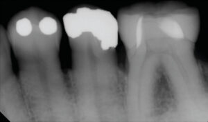 Digital Dentistry Radiographic