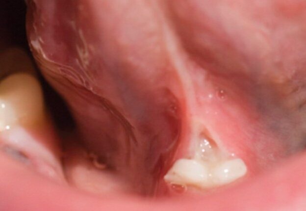 Dental Laser Applications in Pediatrics course image
