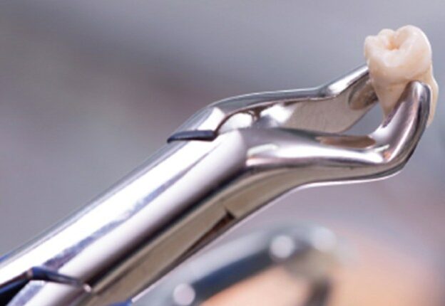Recognition and Management of Complications in Third Molar Surgery course image