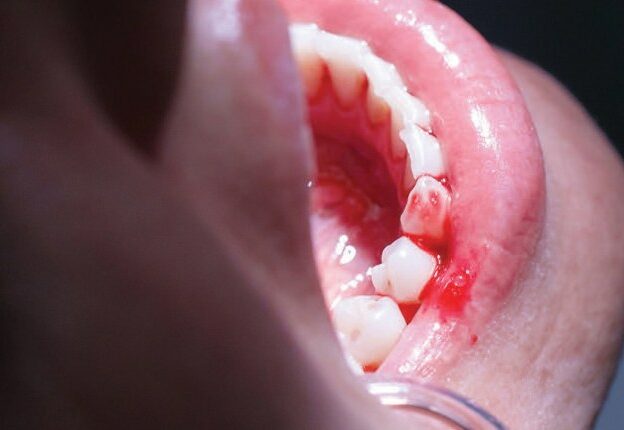 Strategies for Managing Periodontal Disease course image