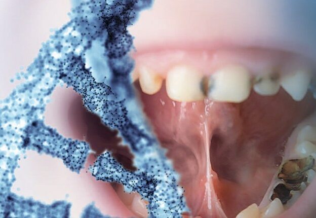 Genetic Determinants of Risk and Resistance to Dental Caries course image