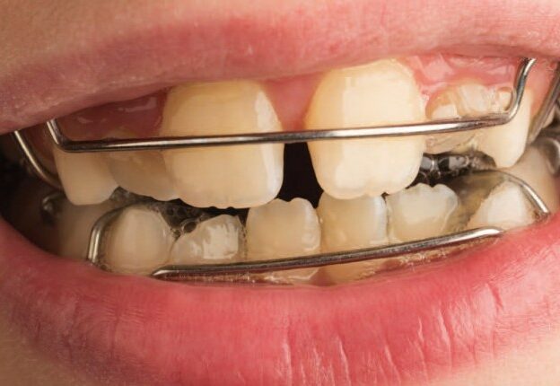 10 Orthodontic Challenges in the Primary and Mixed Dentition course image