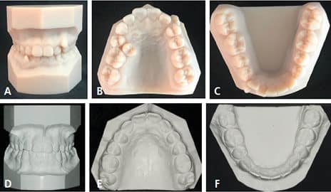 Orthodontic Practice Study Models