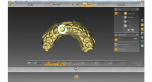 Surgical guide for digital workflow