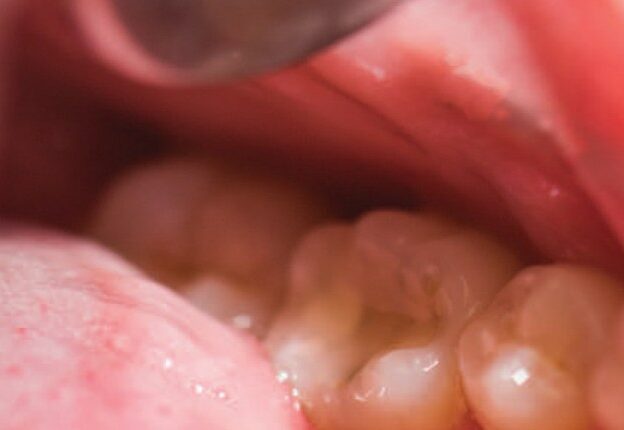 Transmucosal Drug Delivery in the Oral Cavity course image