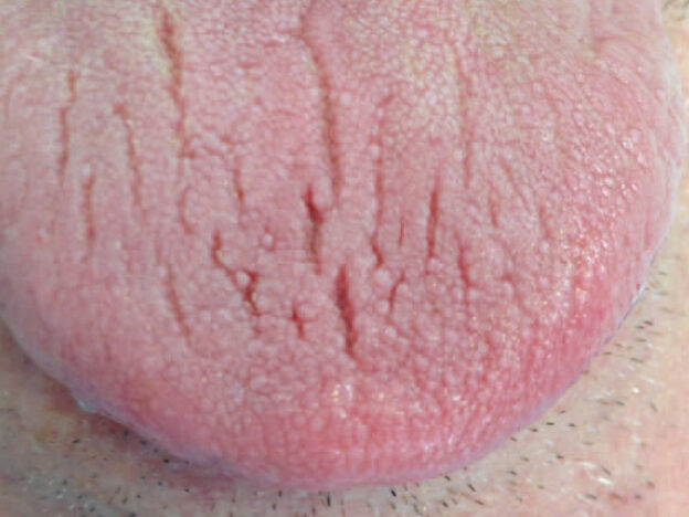 Addressing Xerostomia course image