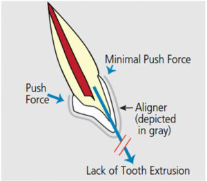 Tooth shape to plan orthodontic treatment