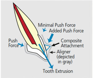 Tooth shape to plan orthodontic treatment