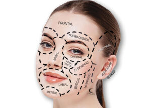 Facial injectables