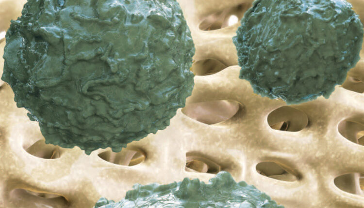 Stem cell