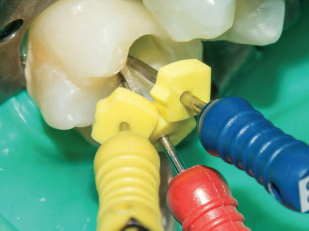 Shaping Strategies in Endodontic Therapy course image