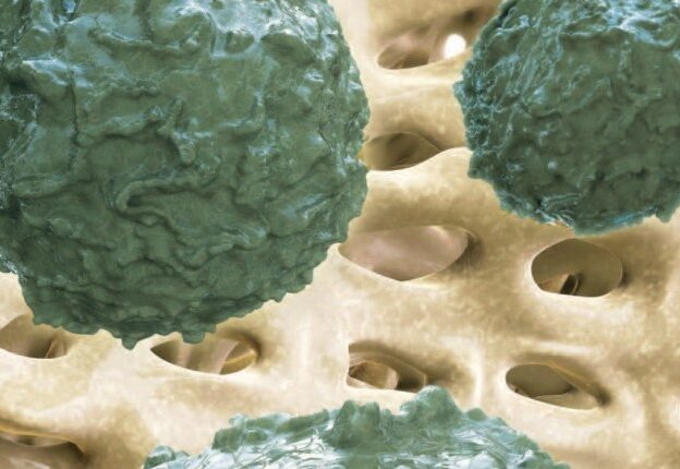 Oral Effects of Hematopoietic Stem Cell Transplant Therapy course image