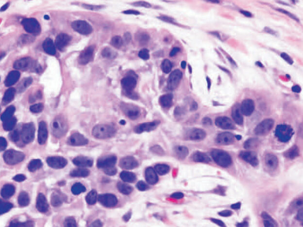 Guidelines for Biopsy of Oral Mucosal Lesions course image