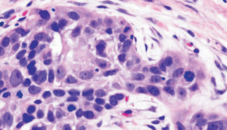 dental code soft tissue biopsy