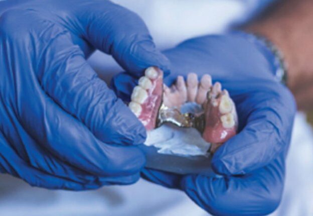 Esthetic Clasp Design for Removable Partial Dentures on Premolar Teeth course image