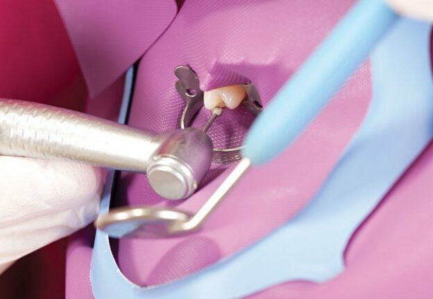 Infection Prevention in Endodontic Therapy course image