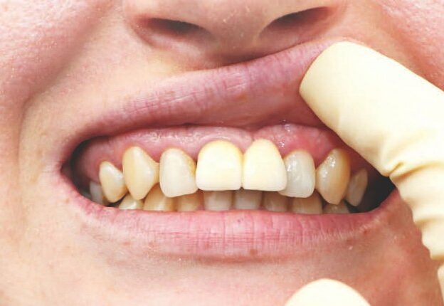 Treatment Planning Strategies For Dental Implant Procedures course image