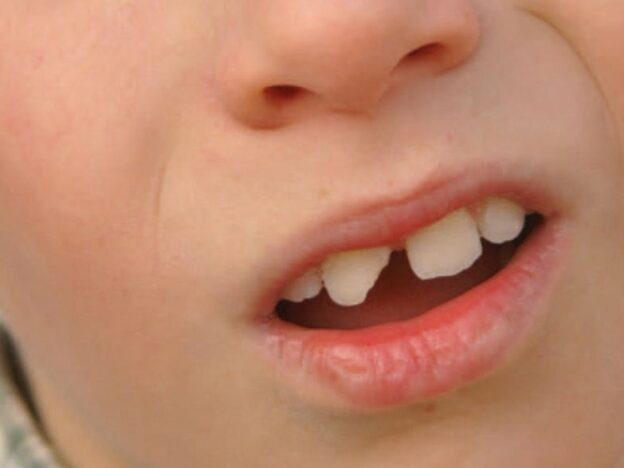 Managing Dental Trauma: A Review course image