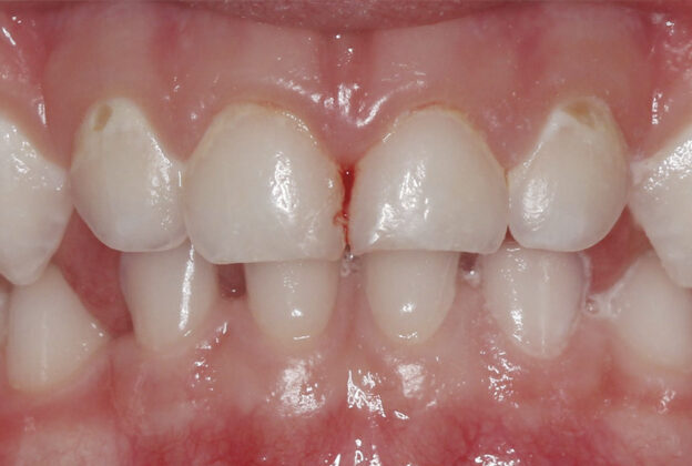 Behavior and Caries Management In Pediatric Dentistry course image