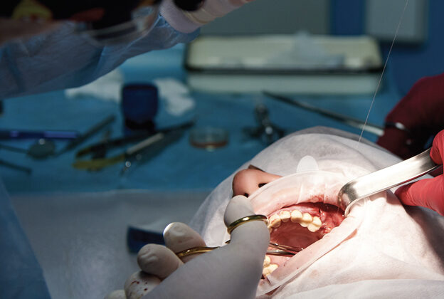Periodontal Grafting in Patients With Inadequate Keratinized Gingiva course image