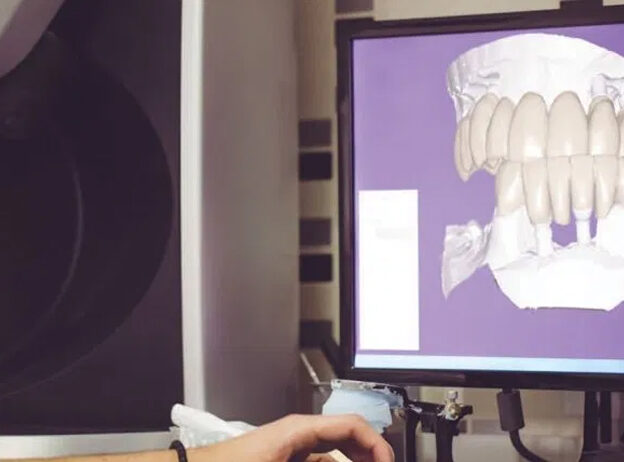 Avoiding Complications During the Restorative Phase of Implant Dentistry course image