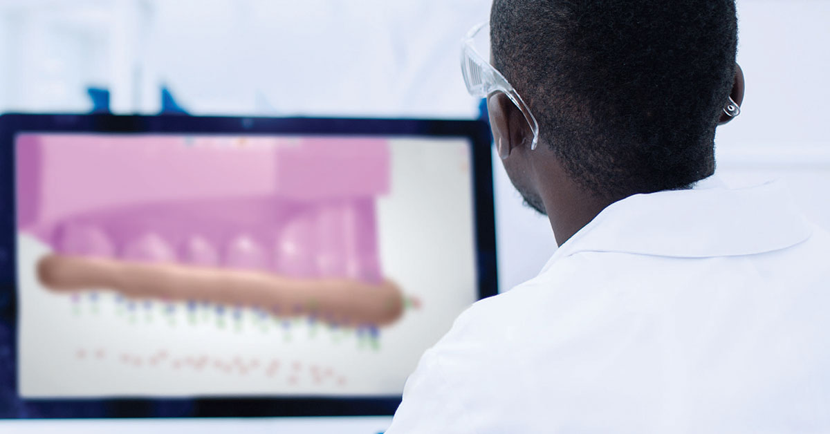 Clinician creating occlusal guards